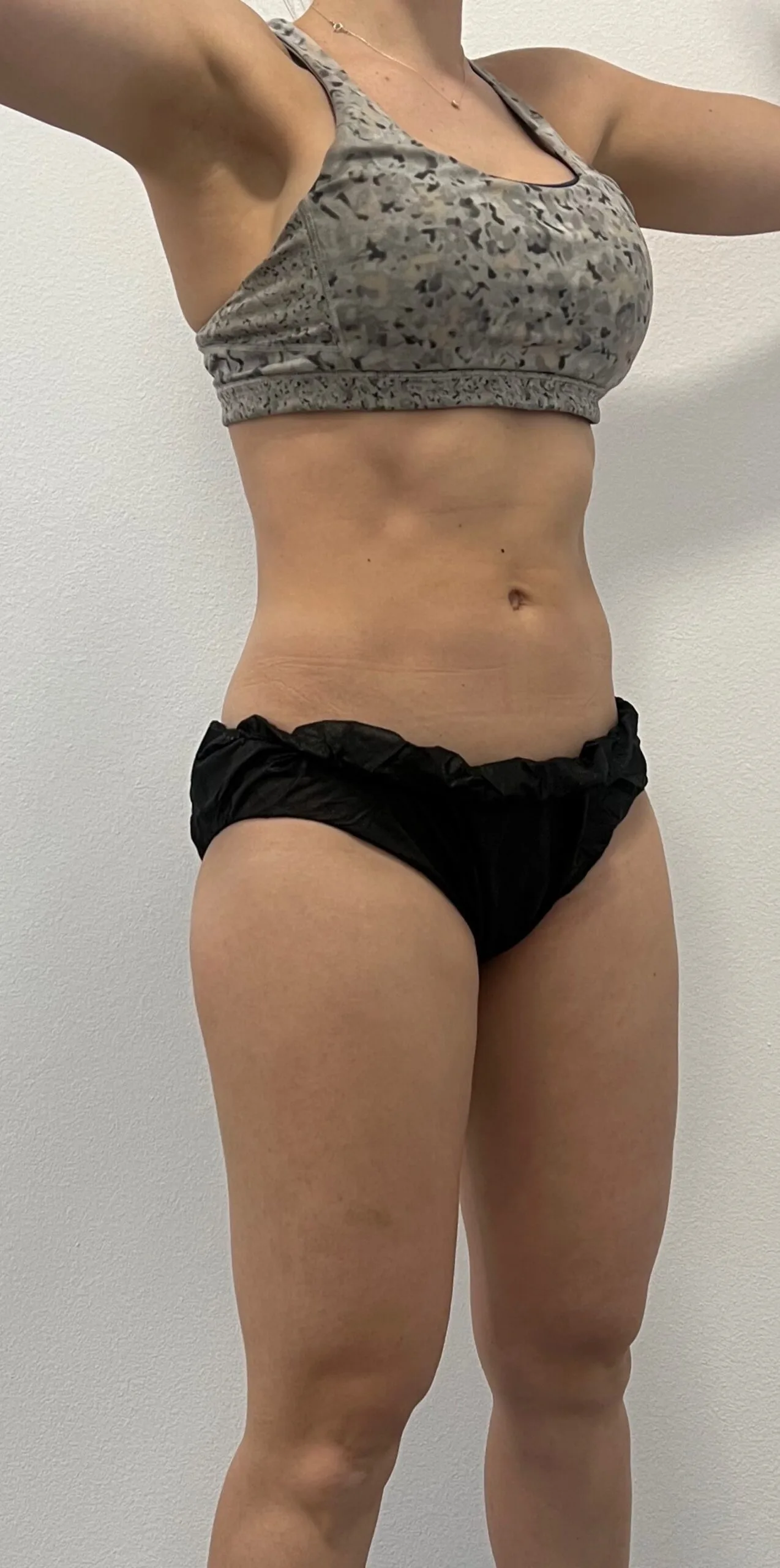 Best SEMAGLUTIDE Weight Loss Treatments In St. Peters, MO Best SEMAGLUTIDE Weight Loss Treatments In St. Peters, MO