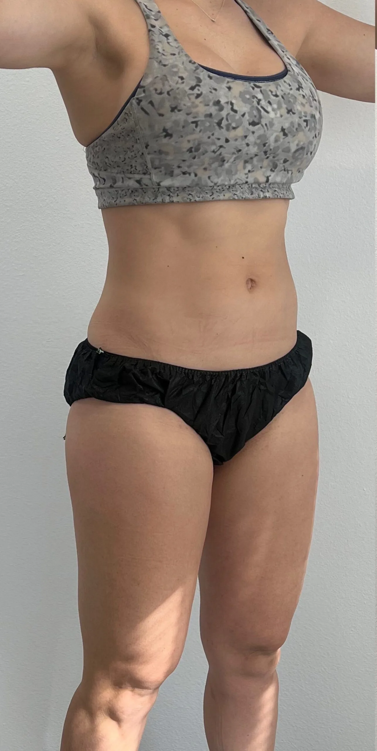 semaglutide st charles Best Weight Loss Treatments In St. Peters, MO GLP-1 Medications St Charles IL
