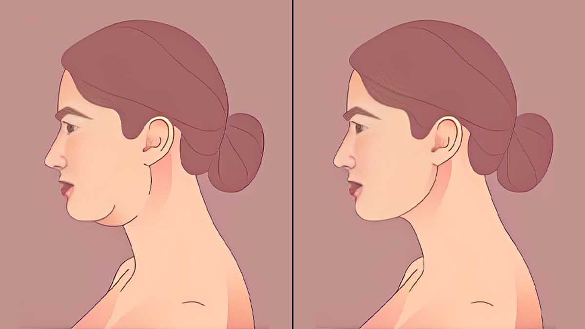 Lose Face Fat
